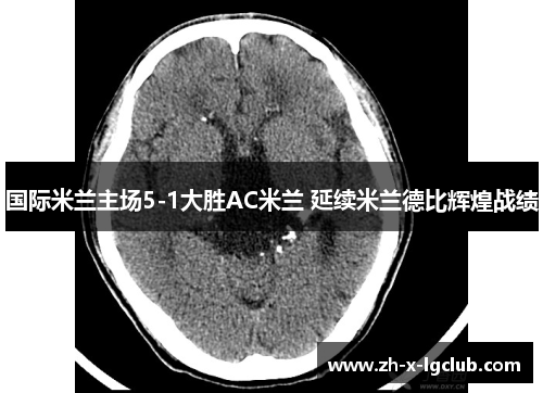 国际米兰主场5-1大胜AC米兰 延续米兰德比辉煌战绩 国际米兰主场5-1大胜AC米兰 延续米兰德比辉煌战绩